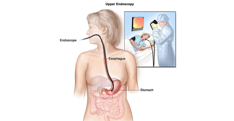 Gastroscopy Treatment In Ghatkopar, Mumbai